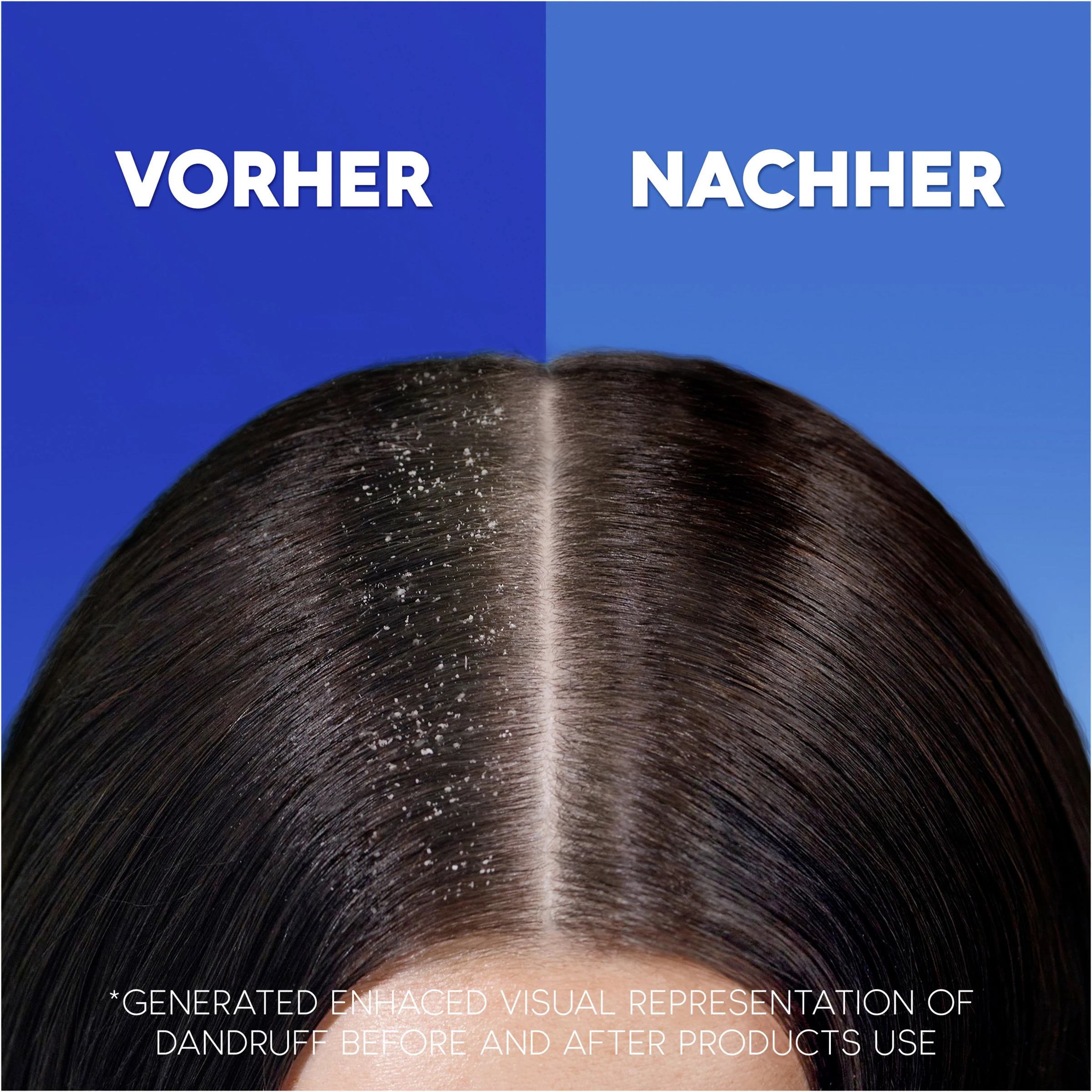 Head & Shoulders Anti-Schuppen Shampoo Apple Fresh 6 Head & Shoulders Anti-Schuppen Shampoo Apple Fresh – Bild 6