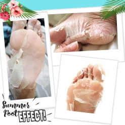 Summer Foot Fußmaske Für Männer 5 Summer Foot Fußmaske Für Männer -Compeed Geschäft MAM 7246377 SHOP IMAGE 1.4