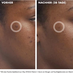 Olay Regenerist Gel-Creme AHA24 + Vitamin C -Compeed Geschäft MAM 8776738 SHOP IMAGE 1.4